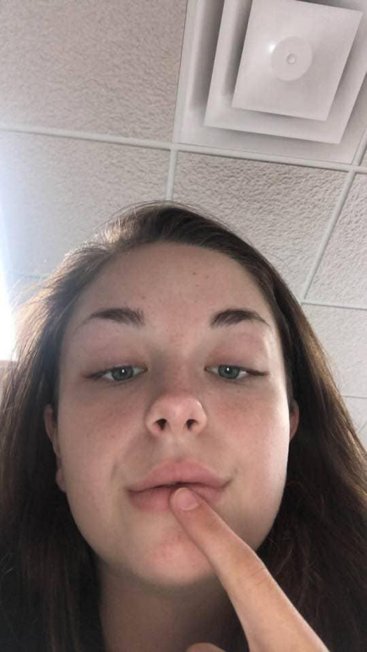 540beac0-382a-11ed-af12-6f38273534e2