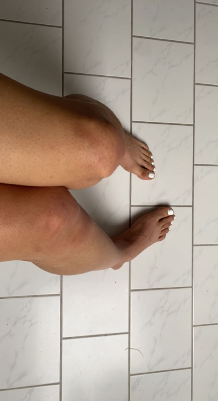 7b334b80-553c-11ed-a704-9746c935bb0e