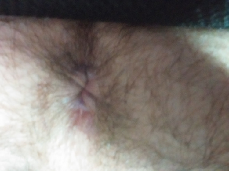 9372dbd0-c8d3-11ed-94cc-e3e3821c189e