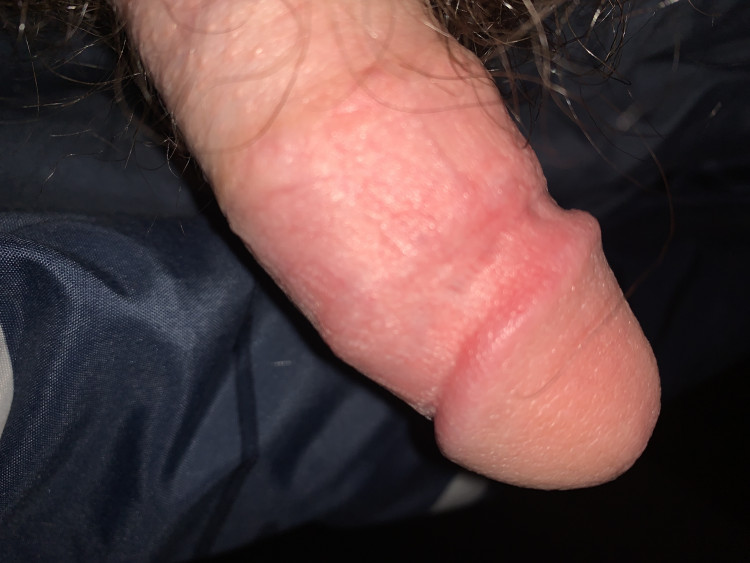 5acf6d20-1538-11ee-9923-f17f24d326c9