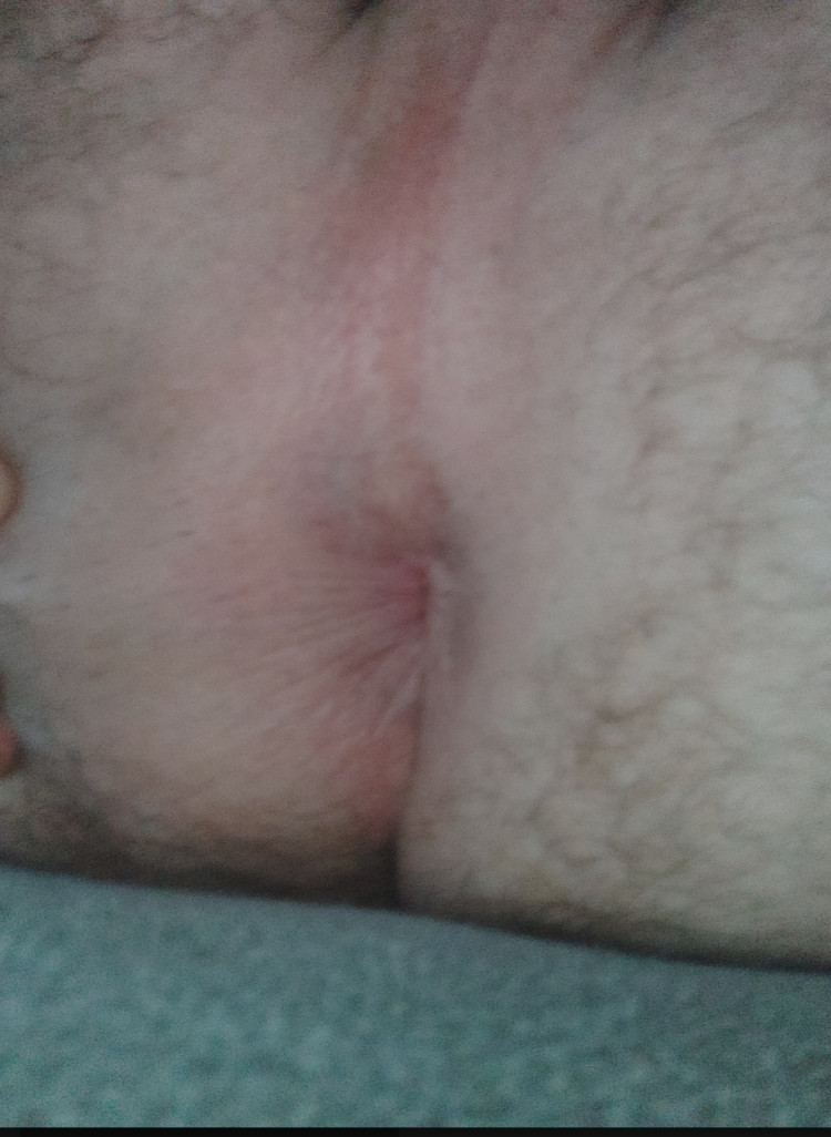 855c7020-0823-11ef-a74e-bba17f9da06f