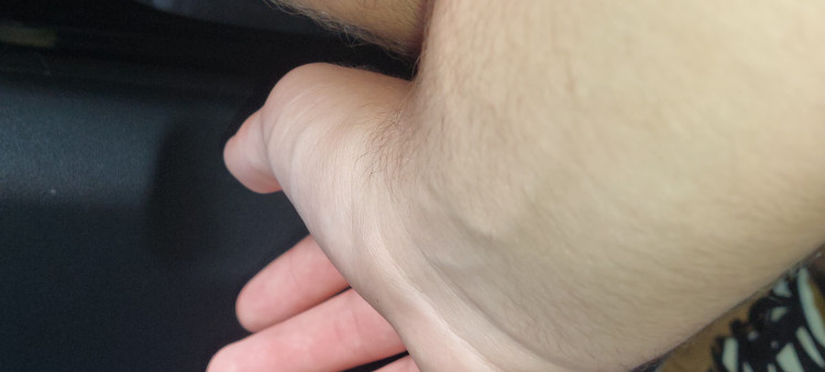 99654e30-3c67-11ee-8cf4-715eddfa4918