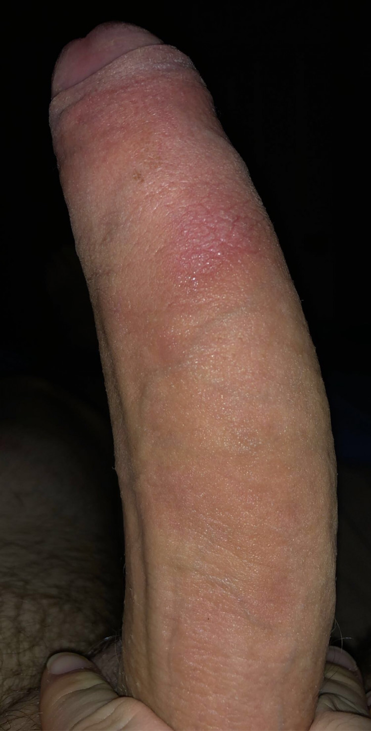 af8b7770-0c11-11ec-acda-07478ae5ec20