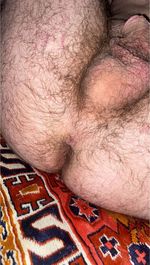 Hairy.patryk picture
