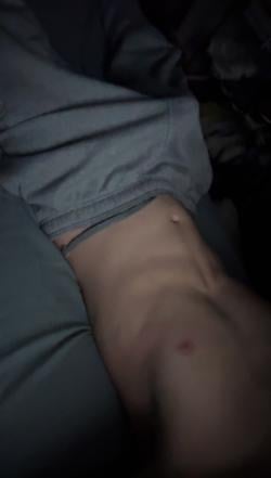 csmd71