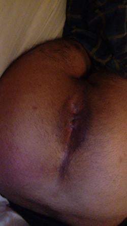 zerorepatriate picture