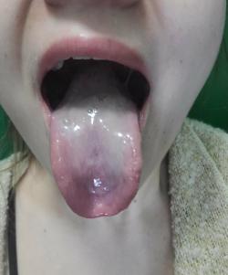 lahpa24