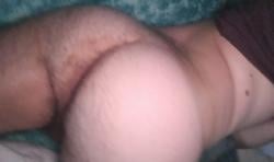 a57826794