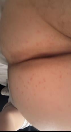 mtl.223