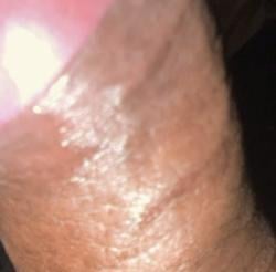 stickxx