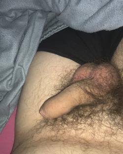 tobiglanz