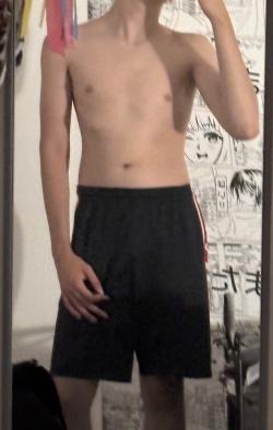 mat20267159
