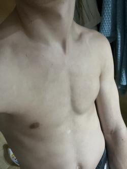 fg2566600