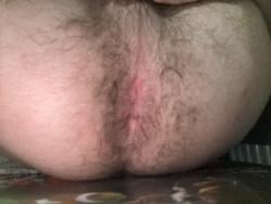 ayogg887remove7