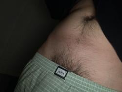 hairy22m