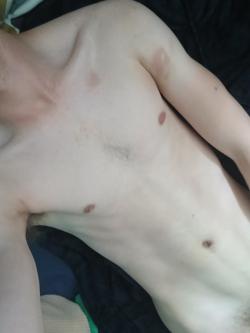 slimscot26