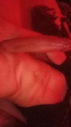 fang4l