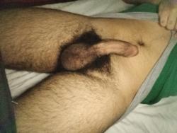 hairy_moe