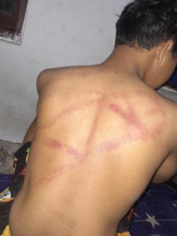 alzasyn picture