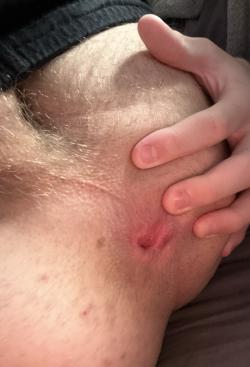 foto de yuplad1_roscommonfuck