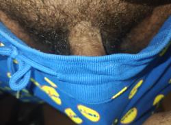 yellowblack21